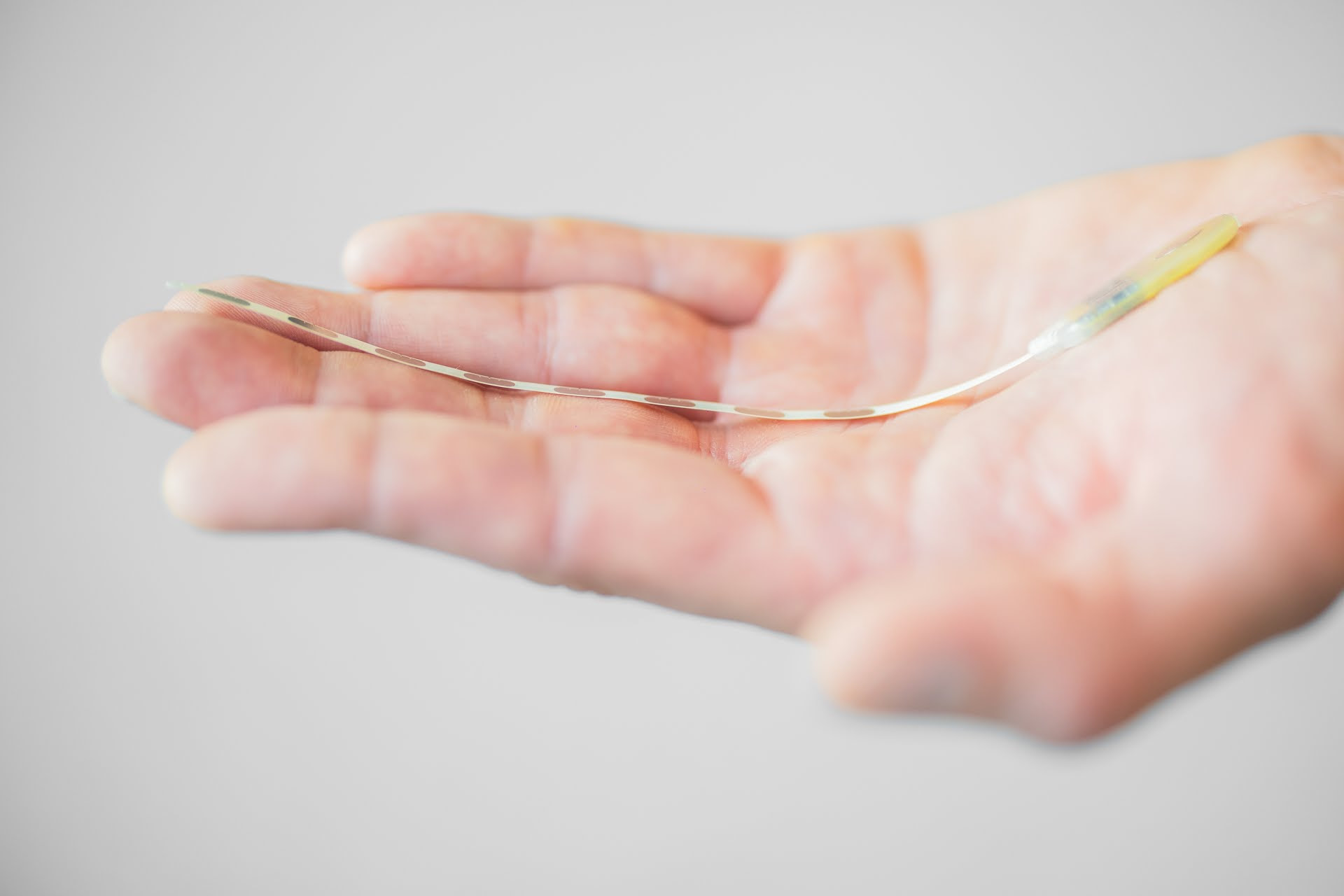 Implants for migraine prevention