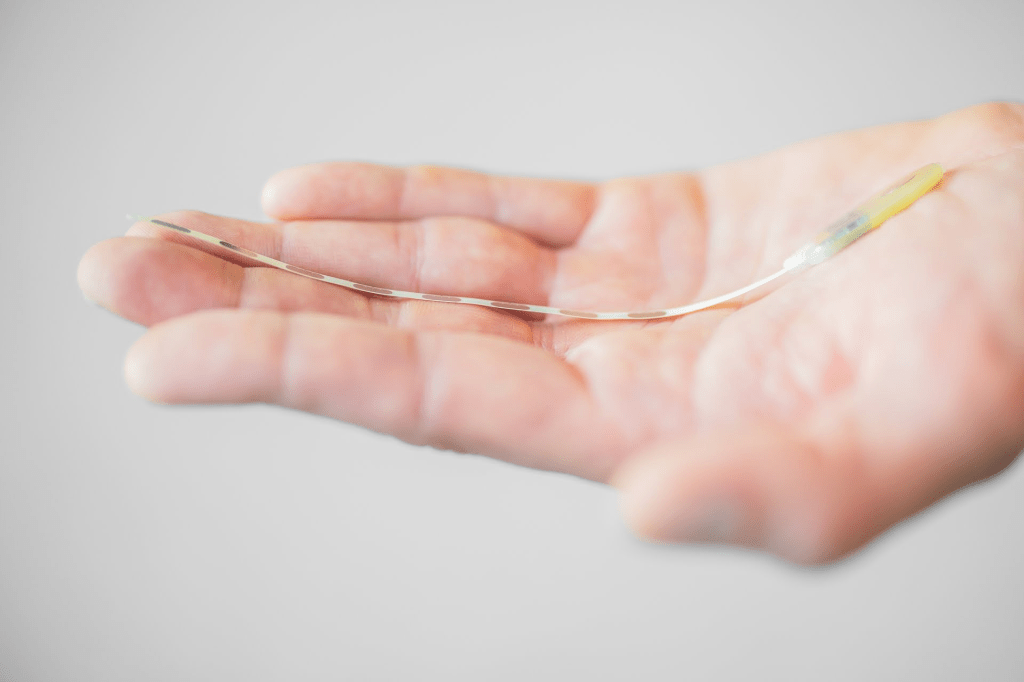 Implants for migraine&nbsp;prevention