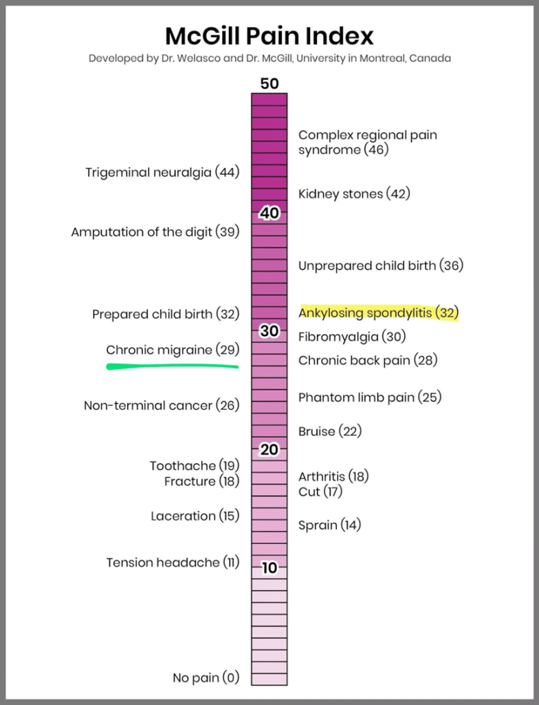 a pain-index chart with Complex regional pain syndrome at 46 out of 50, migraine at 29, a bruise at 22 and a tension headache at the lowest at 11.